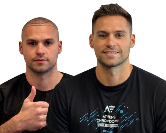 Estefarya Hair Transplant